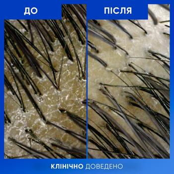 Head&Shoulders Cleansing and Shine Shampoo 400ml - buy, prices for Auchan - photo 7